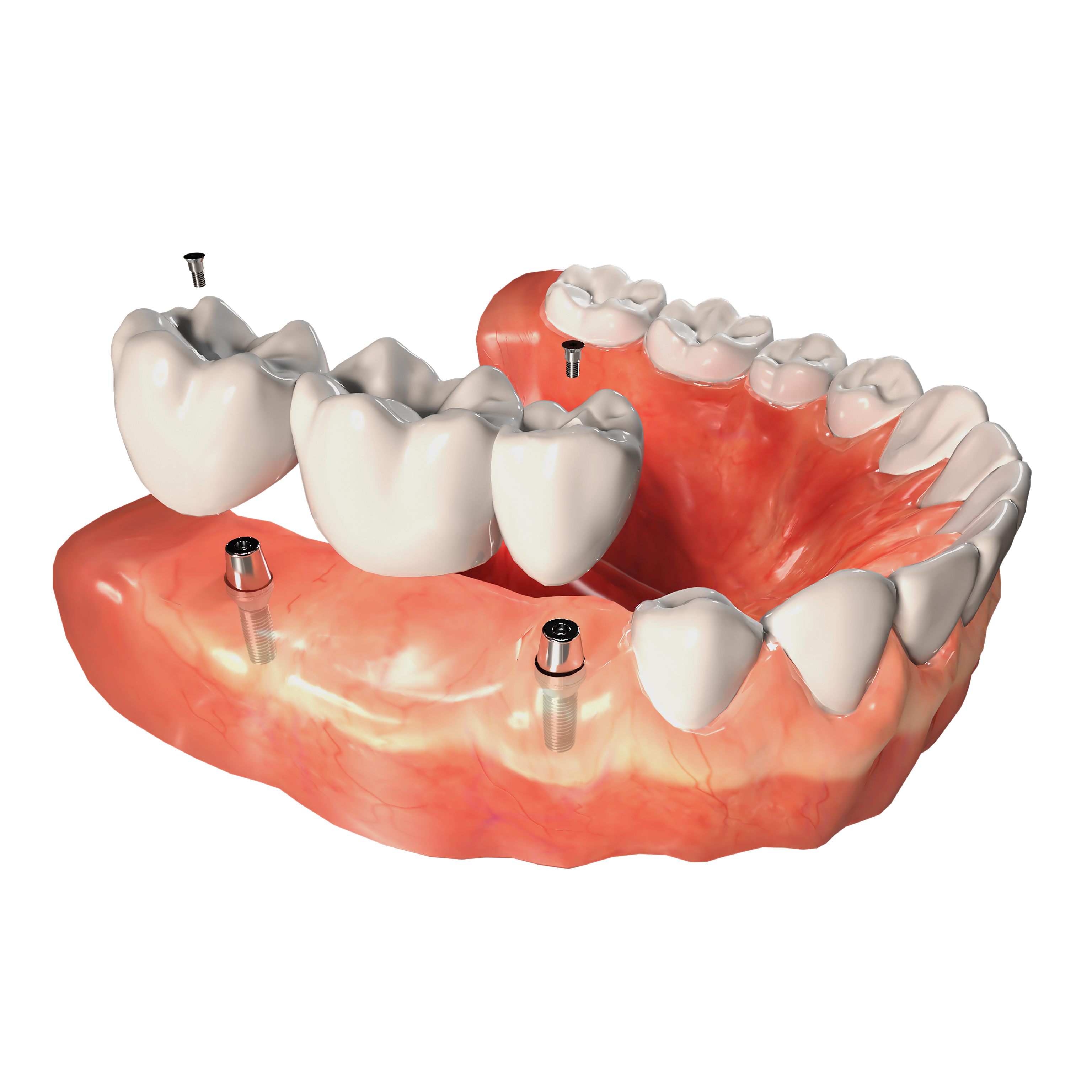Abercorn Dental | Root Canals, Invisalign&reg; and CBCT